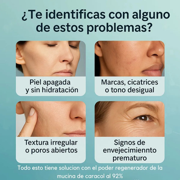Crema Facial Baba de Caracol al 92%