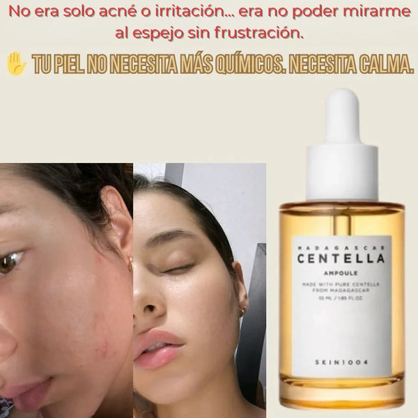 🌿 Serum Centella real de Madagascar-🎉¡HOY CON 30% DCTO!