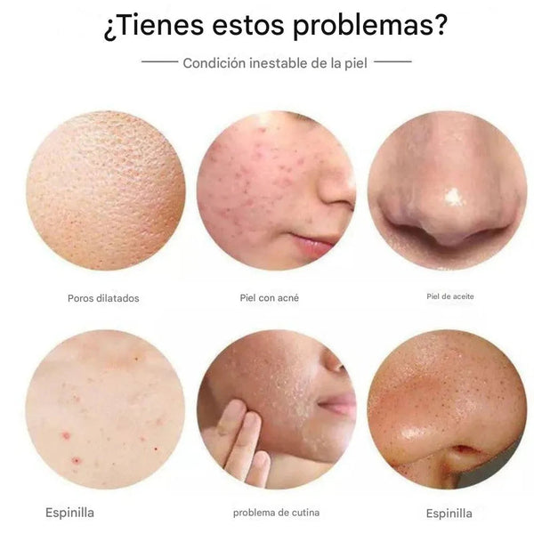 Sérum facial con Ácido Kójico y Niacinamida